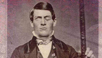 Удивительная история Финеаса Гейджа